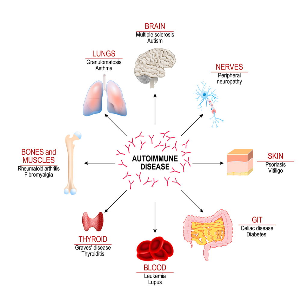 What is Autoimmune Disease?